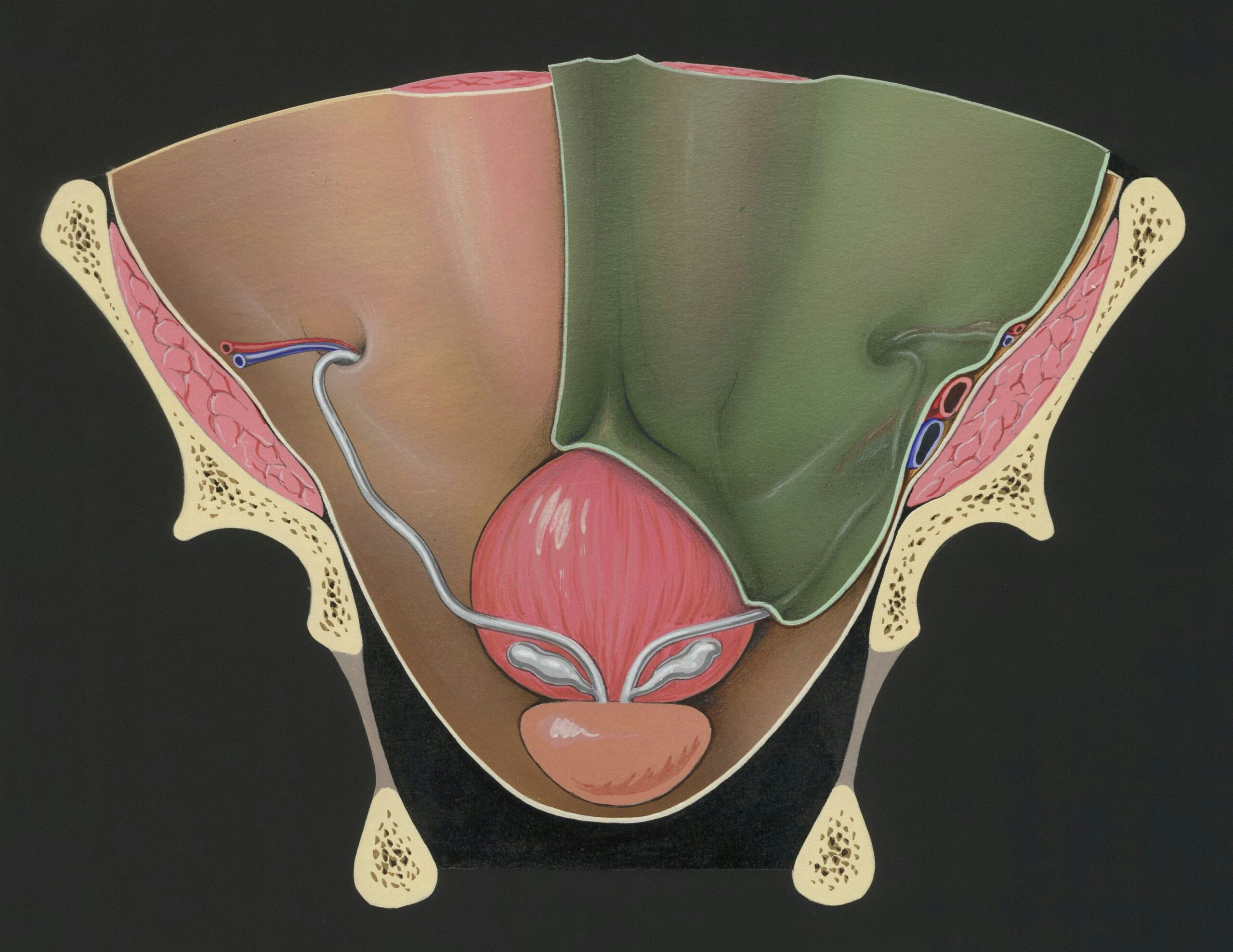 Prostate and adjacent tissue 