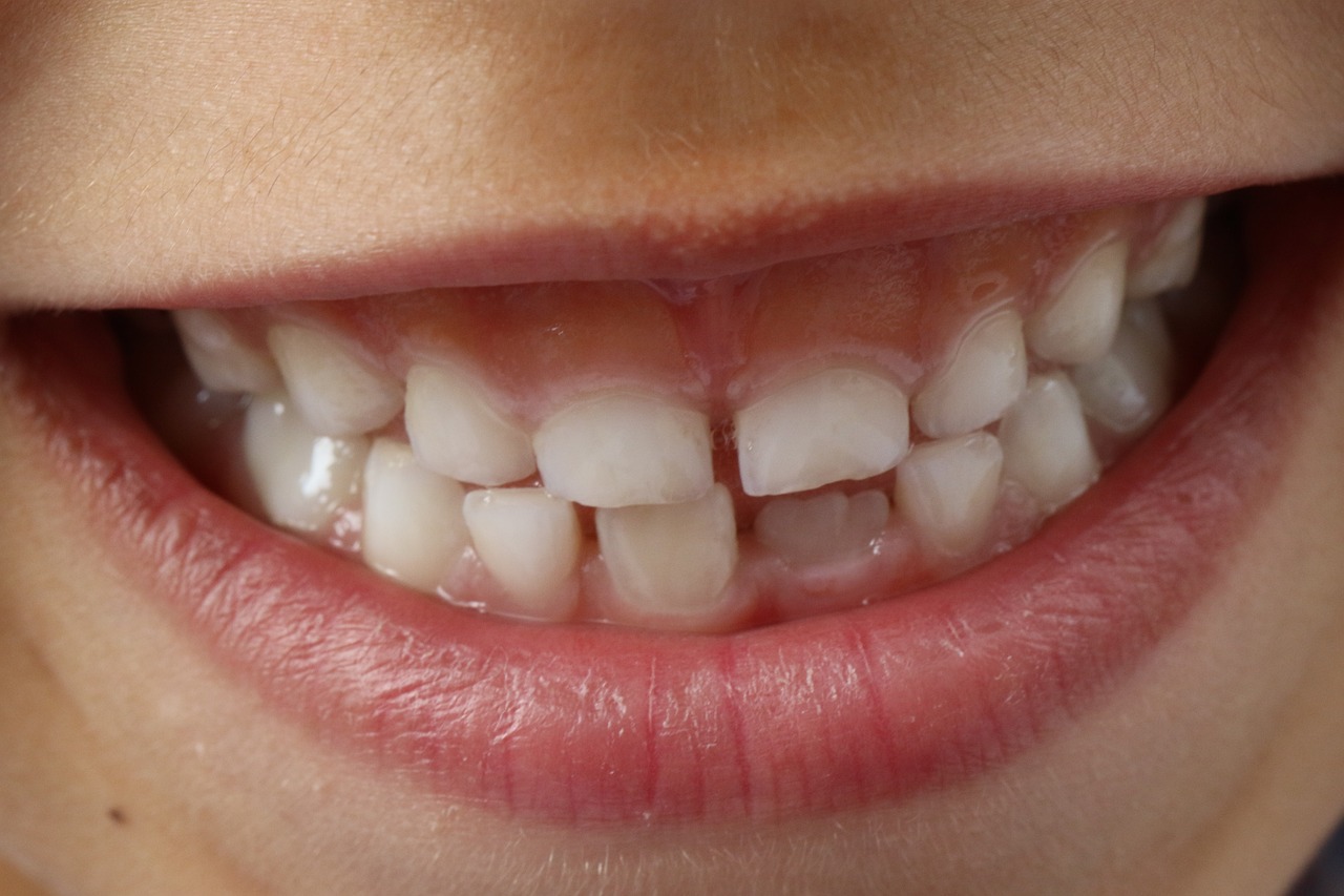 image of teeths